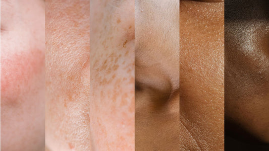 FAQ soins de la peau : on répond à vos questions